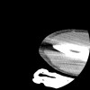 SPORK, NICO - 22.03.1976 - 02.08.2022 - CT obere Extremität - 17:51:17